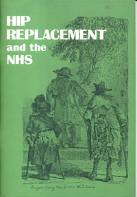 Hip Replacement in the NHS