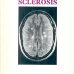 162 - 1987 multiple sclerosis