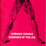 196 - 1992 chronic venous disease