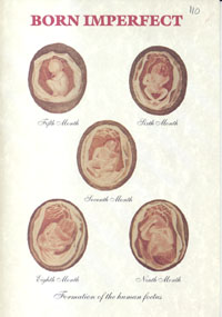 Born Imperfect: The role of genetic disease