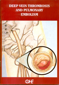 Deep Vein Thrombosis and Pulmonary Embolism