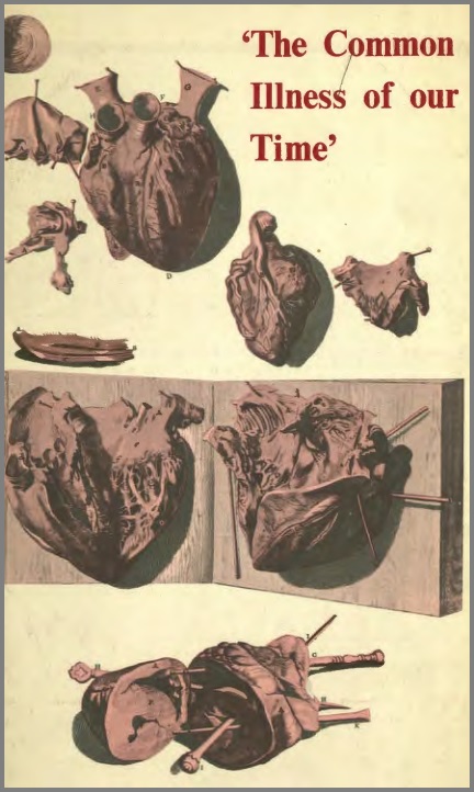 Common Illness of Our Time: a Study of the Problem of Ischemic Heart Disease