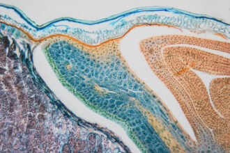 Cell microscopic- weevil rye