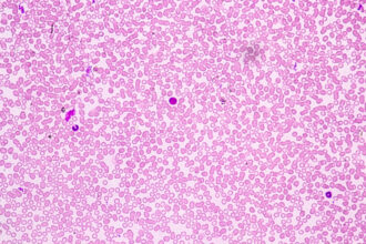 Field of densely packed pink-red blood cells stained with Wright-Giemsa, showing predominantly round RBCs.