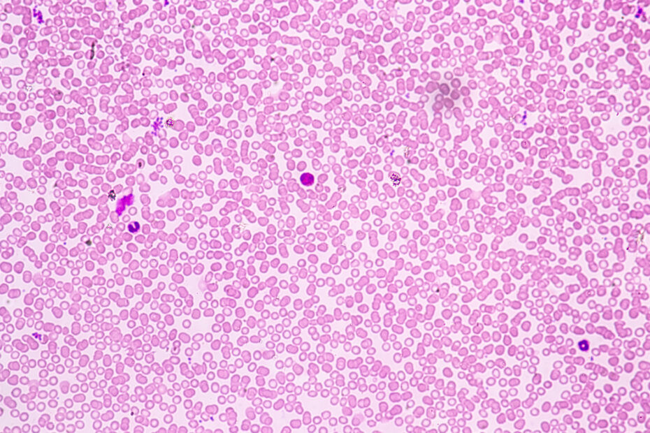 Field of densely packed pink-red blood cells stained with Wright-Giemsa, showing predominantly round RBCs.